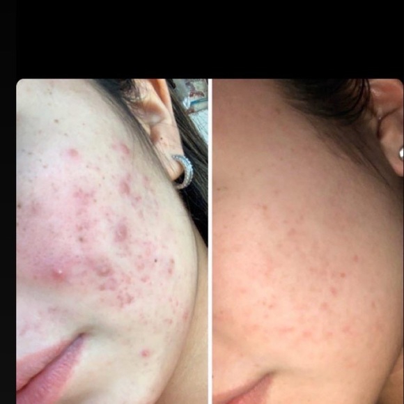 Skin care - Picture 3 of 4